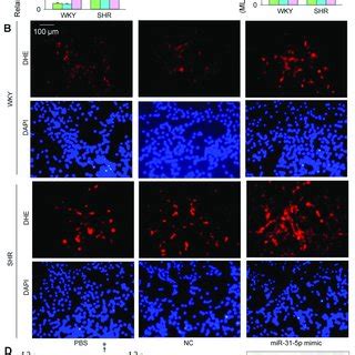 Effects Of The MiR 31 5p Mimic On Oxidative Stress In VSMCs Of WKY And