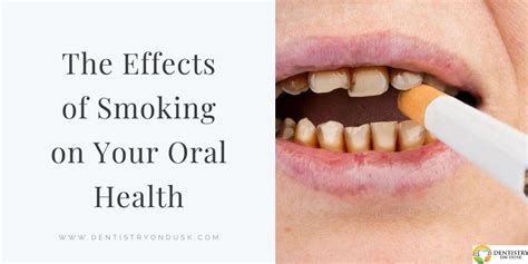 Effects Of Smoking Cigarettes On Teeth