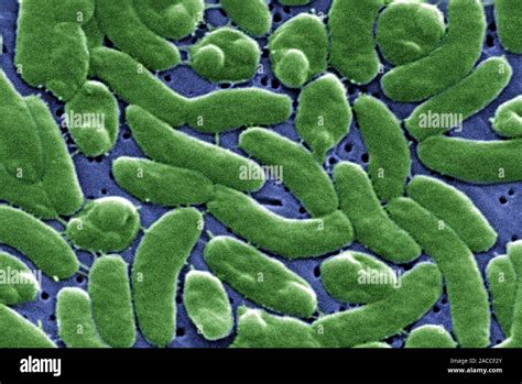 Vibrio Vulnificus Bacteria Coloured Scanning Electron Micrograph SEM