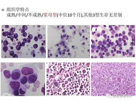 浆细胞特点浆细胞和淋巴细胞大山谷图库