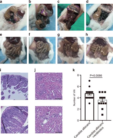 Pretreatment with antibiotics aggravates fungal infection in newborn ...