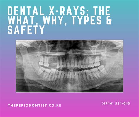 Dental X Rays The What Why Types And Safety