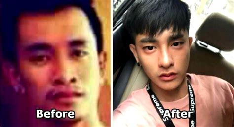 Thai Man Had Over 30 Plastic Surgeries And Looks Completely Different