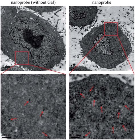 TEM Images Of Cellular Uptake Of Nanoprobe Without Gal And Nanoprobe