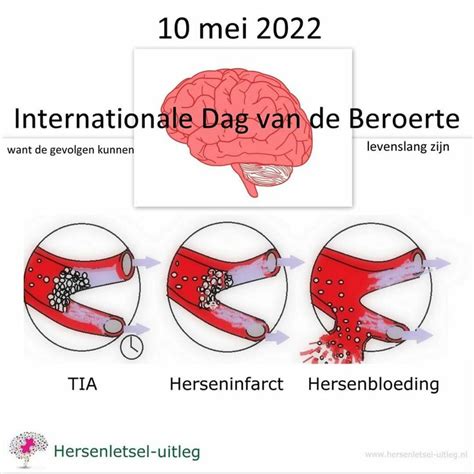 Pin Van Overprikkeling Op Hersenletsel Overprikkeling