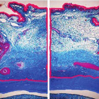 Representative Photomicrographs Of The Sections Obtained From Eyes