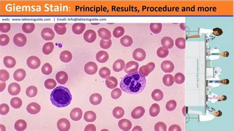 Giemsa Stain Principle, Results, Procedure and more | Lab Tests Guide