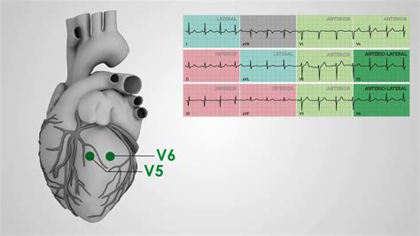 EKG Heart Diagram