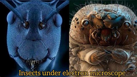 insects under electron microscope 🔬 in 2023 | Things under a microscope ...