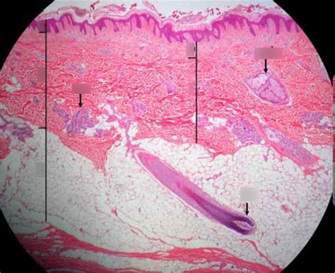 Dermis Histo Diagram | Quizlet