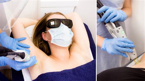 8 Things You Should Know Before Having Laser Hair Removal Heart