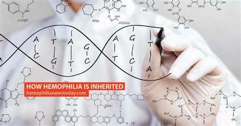 How Hemophilia Is Inherited | Hemophilia News Today