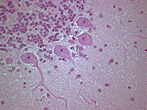 Pyramidal Cell Histology