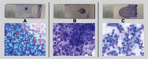 Solid Tissue Cytology Hints To Avoid Poor Quality Samples College