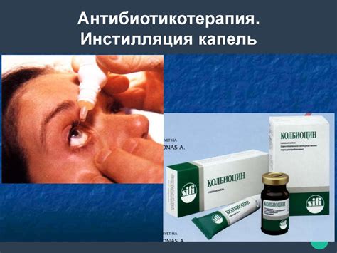 Роговица. Свойства и функции роговицы - презентация онлайн