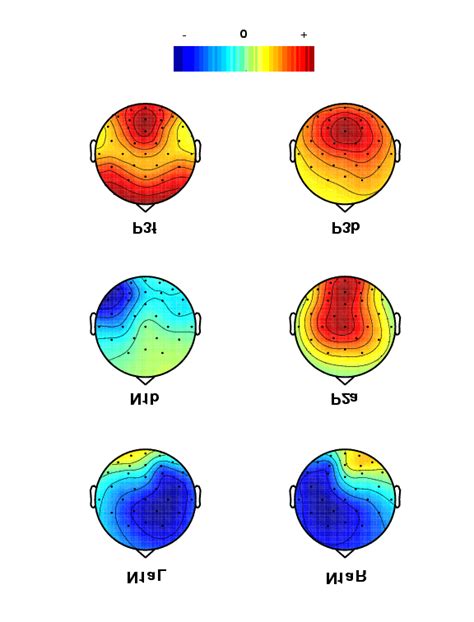 B Scalp Maps Of The Largest Six Independent Components Individually