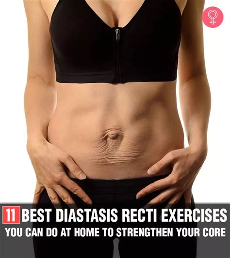 Diastasis Recti Abdominal Separation Exercises And How To Fix