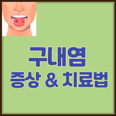 구내염 원인 증상 치료 방법 구내염 빨리 낫는 법