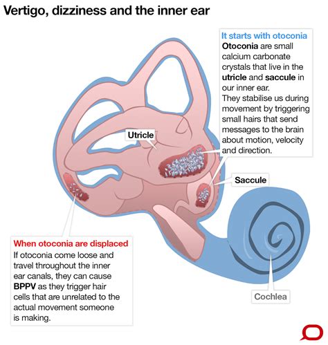 Health Check: why do we get dizzy?