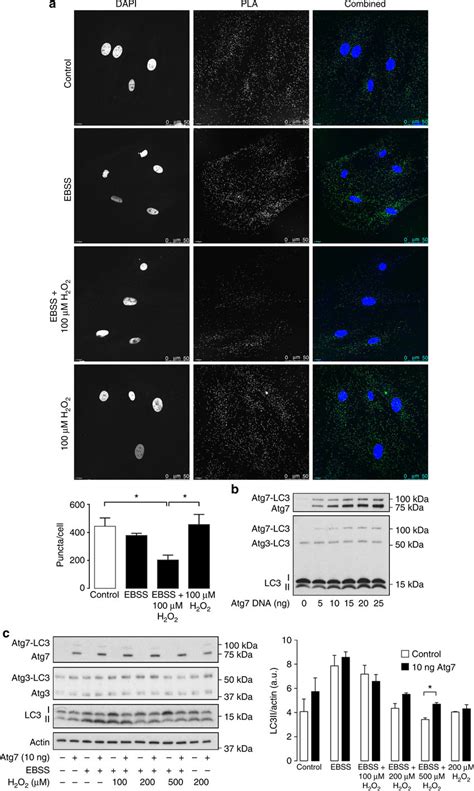 Atg Overexpression Attenuates Oxidant Dependent Loss In Lc