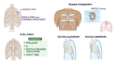 Anatomy Clinical Correlates Thoracic Wall Video Osmosis