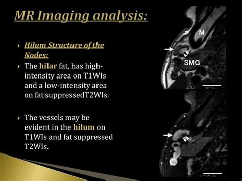 Imaging of cervical lymph nodes | PPT