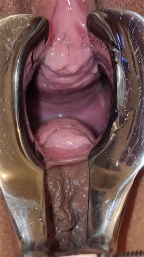 Spekulum Nasse Vagina Doctor MILF Porn Feat Electro83 XHamster
