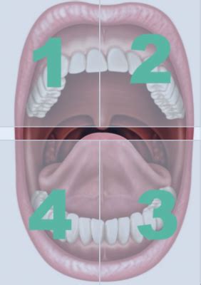 Tutorial Root Surface Debridement Flashcards Quizlet