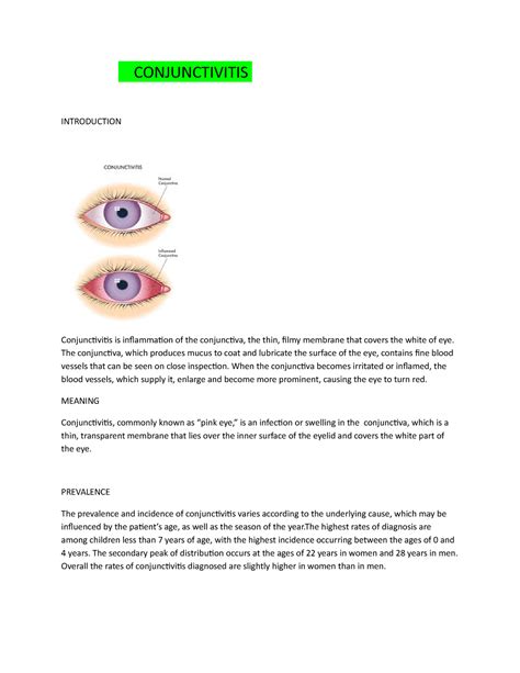 Conjunctivitis Wps Office Conjunctivitis Introduction Conjunctivitis