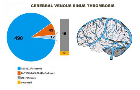 Cerebral Venous Sinus Thrombosis Following Covid 19 Vaccination