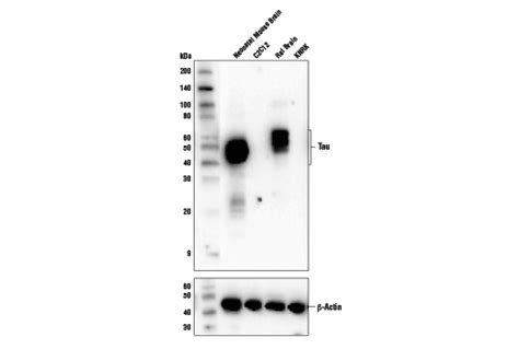 Tau D M X Xp Rabbit Mab Bsa And Azide Free Cell Signaling Technology