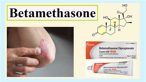 Betamethasone Youtube