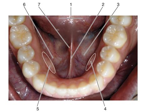 What Does A Healthy Mouth Floor Look Like Infoupdate Org