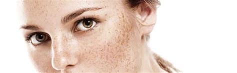 What is skin pigmentation? causes & natural home remedies for it ...