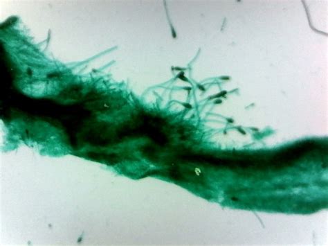 Mold (Three Types) Prepared Microscope Slide (Aspergillis, Penicillium ...