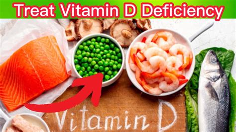 How To Treat Vitamin D Deficiency Naturally Healthcare Secrets Youtube