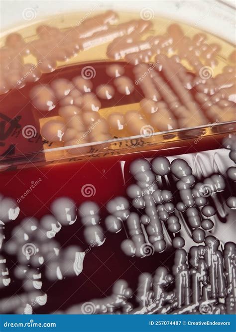 Klebsiella Pneumoniae Bacteria Growing On Blood And Macconkey Agar