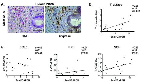 Snail Expression In Human Pdac Tumors Correlates With Mast Cell Download Scientific Diagram