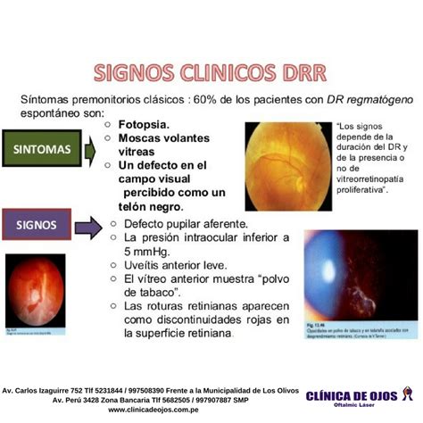 Clínica de Ojos Oftalmic Láser SIGNOS CLÍNICOS DRR