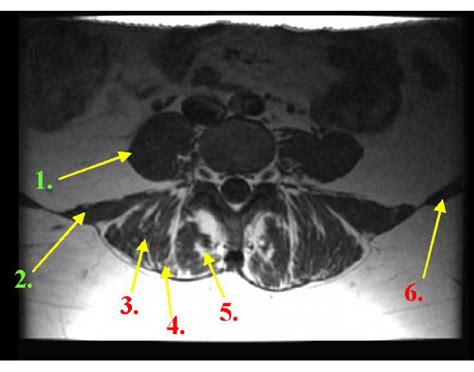 Muscles of the Spine Lumbar Quiz