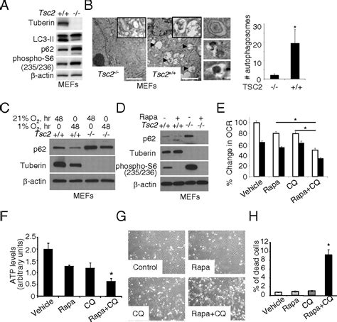 Tumorigenesis In Tuberous Sclerosis Complex Is Autophagy And P62