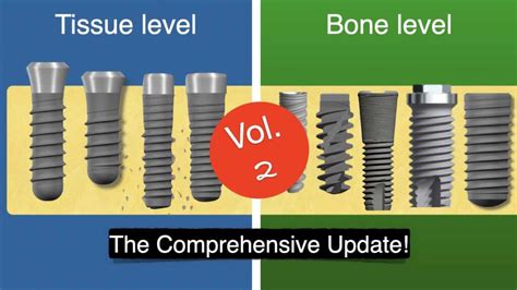 Tissue Level Bone Level Implants Implant Dentistry Nikos Mattheos