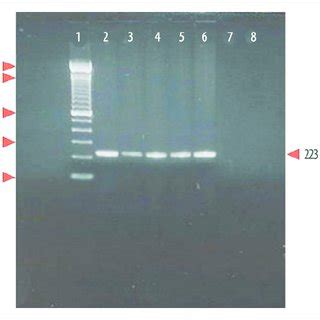 Electrophoretic Analysis And Ethidium Bromide Staining Of DNA Amplifi