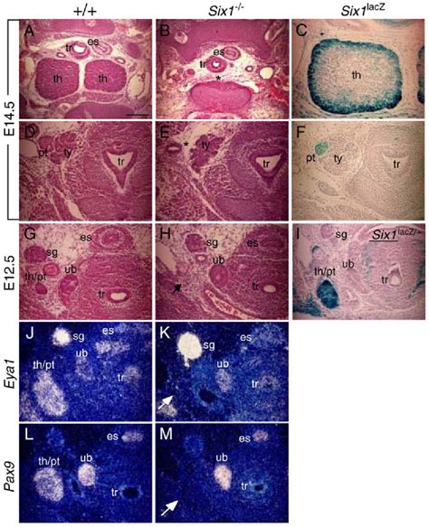 Figure 3 From Patterning Of The Third Pharyngeal Pouch Into Thymus