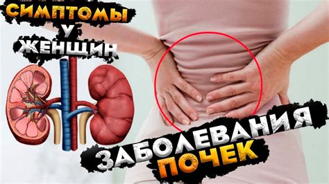 Заболевания почек, симптомы у женщин | Болят почки - YouTube