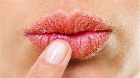 Dry Lips The Causes Treatments And Products To Try Now Glamour Uk