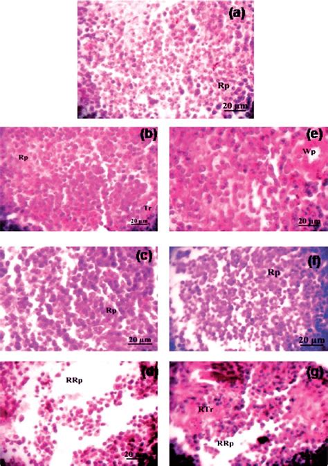 Histology of spleen of mice (H&E): (a) control, (b) 2.5 mg kg À1 SNP ...