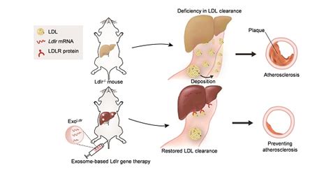 Exosome Based Ldlr Gene Therapy For Familial Hypercholesterolemia In A