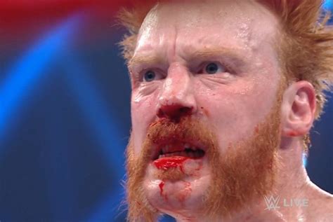 Photos And Video Sheamus Busted Open On Wwe Raw