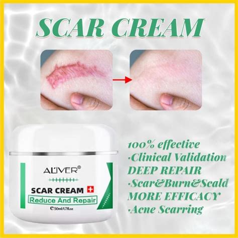 Aliver Scar Remover Peklat Scarminator Cream Strech Mark Remover Pimple